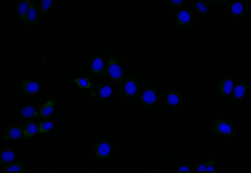 LYVE-1 Antibody (11C11)