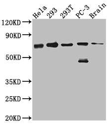 Leukotriene A4 Hydrolase/LTA4H Antibody (6G7)