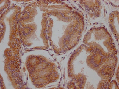 Lysyl Oxidase Homolog 2/LOXL2 Antibody (2E5)