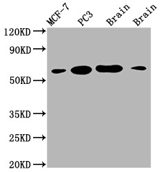 Lysyl Oxidase Homolog 2/LOXL2 Antibody (2E5)