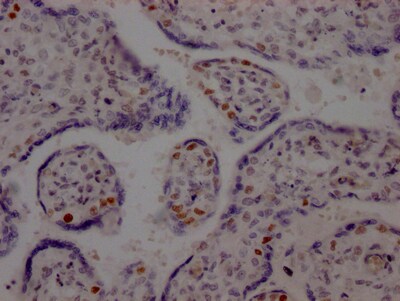 DNA Ligase I Antibody (7B2)