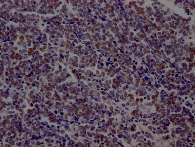 DNA Ligase I Antibody (7B2)