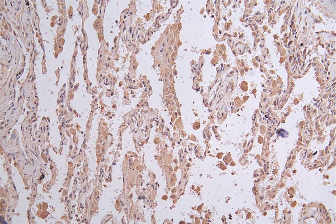 Lgr6 Antibody (15G3)