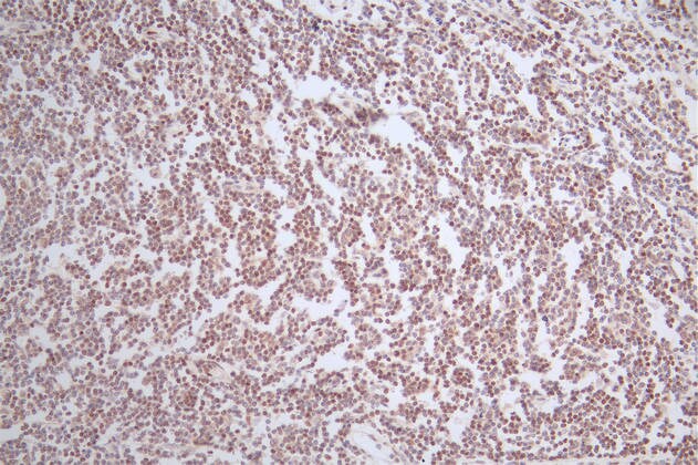 LEF1 Antibody (13B7)