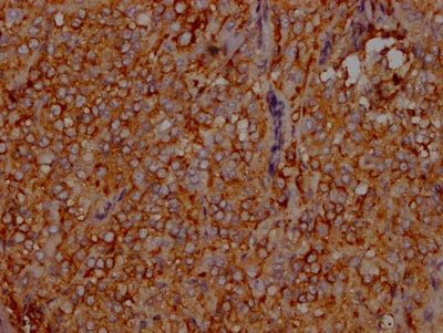 LDLR Antibody (2B10)