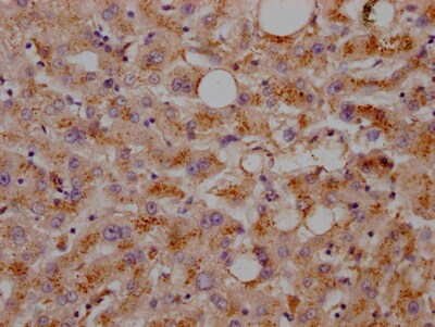 LDLR Antibody (2B10)