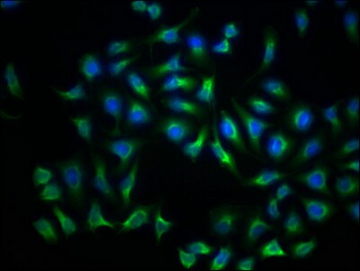 LDLR Antibody (2B10)