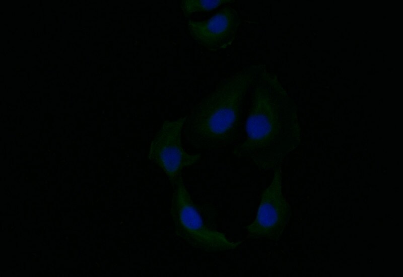 Cytokeratin 6a Antibody (21E2)