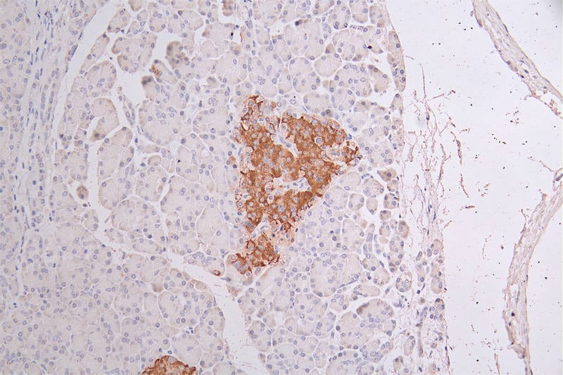 Cytokeratin 10 Antibody (18B6)