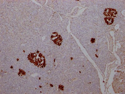 Insulin Antibody (1F6)