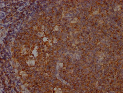 SHIP Antibody (9G11)