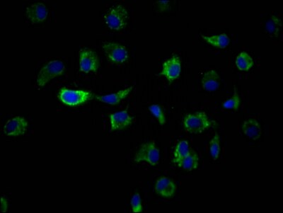 ILK Antibody (6A5)