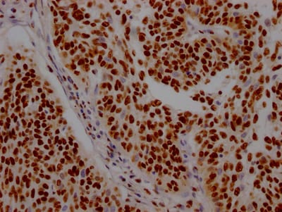 ILF3 Antibody (7H8)