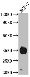 IGFBP-2 Antibody (7G11)