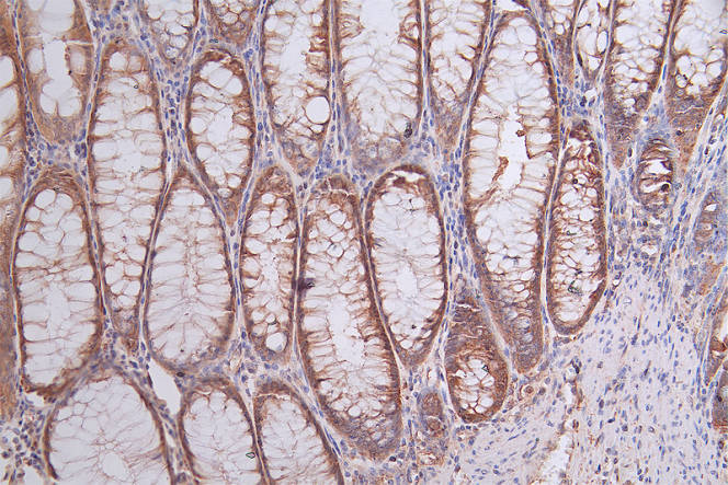 HSP90 beta Antibody (7F4)