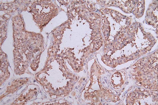HSP90 beta Antibody (7F4)