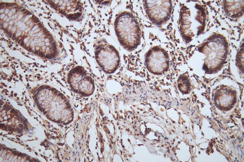 HSP90 beta Antibody (7G7)