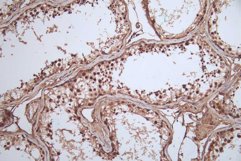 HSP90 beta Antibody (7G7)