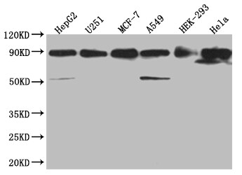 HSP90 beta Antibody (7G7)