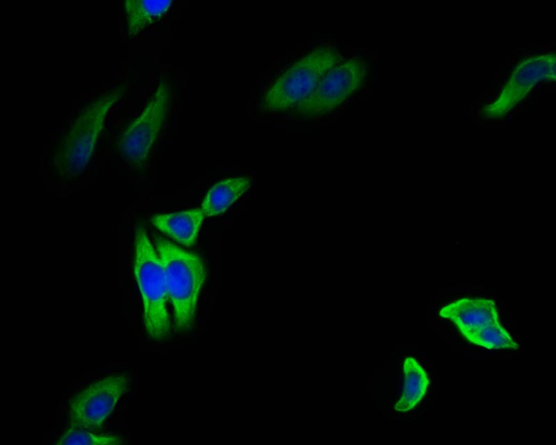 HSP90 beta Antibody (7G7)