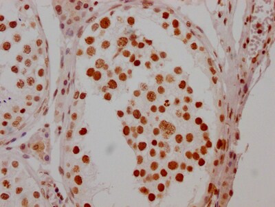HSF1 Antibody (5C7)