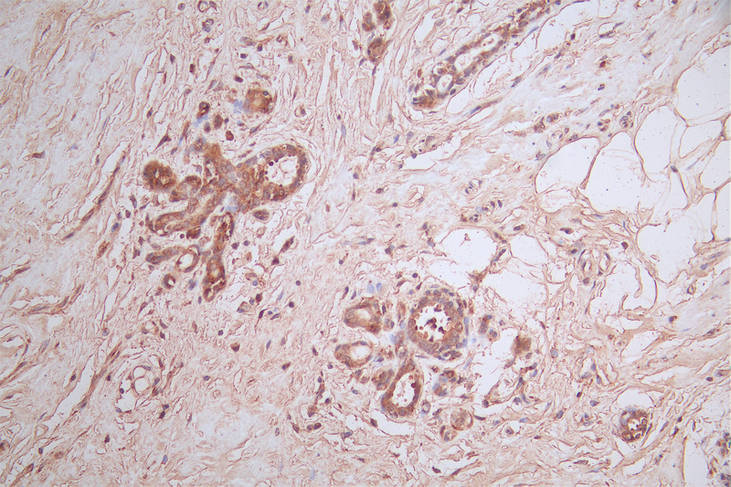 HSD3B1 Antibody (10G2)