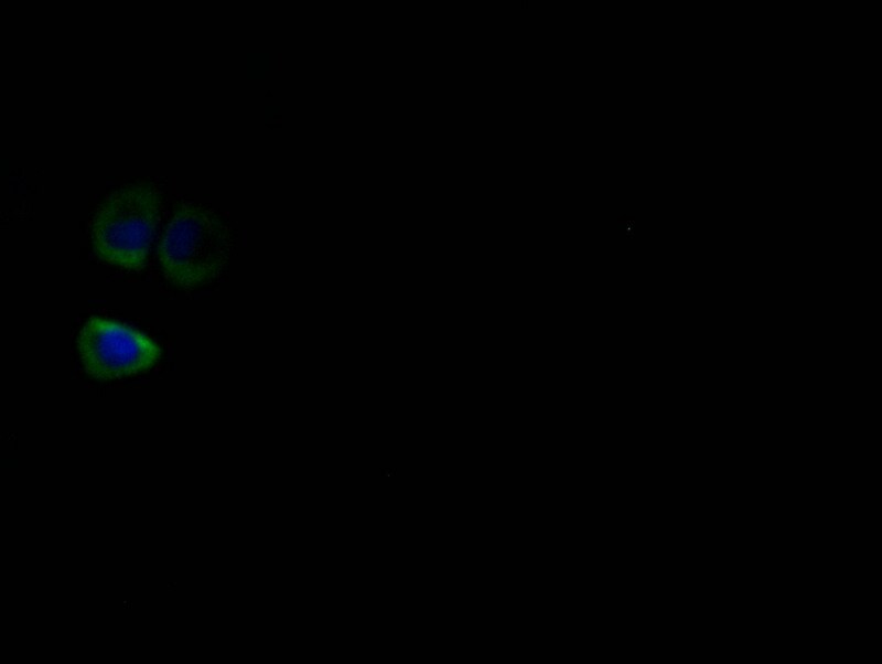HSD3B1 Antibody (10G2)