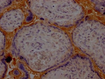 Haptoglobin Antibody (5A5)