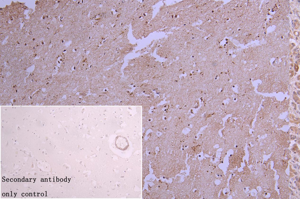 hnRNP C1 + C2 Antibody (9G1)