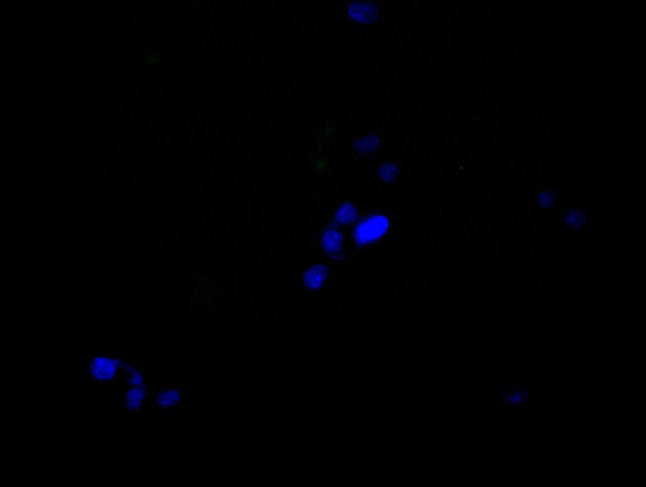 hnRNP C1 + C2 Antibody (9G1)
