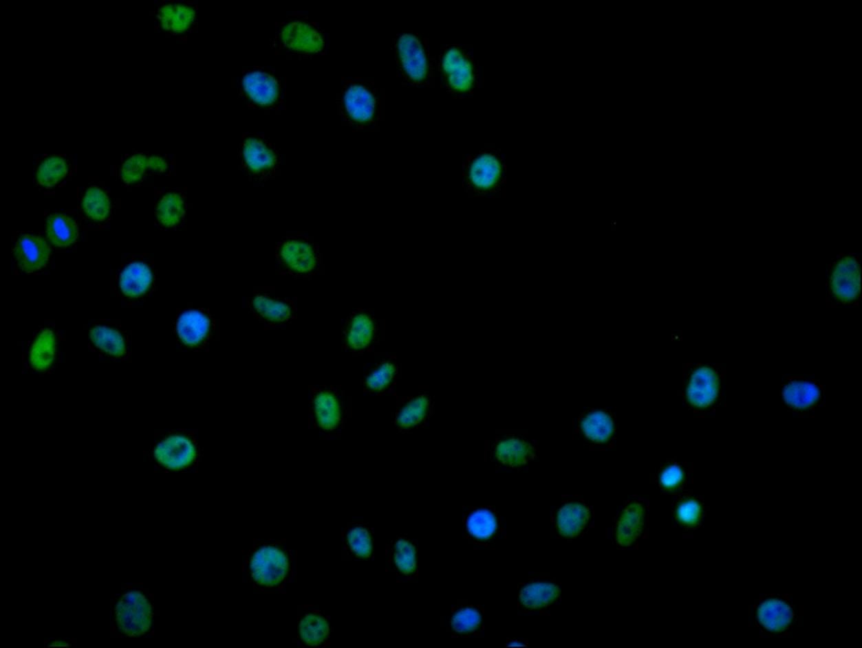 hnRNP C1 + C2 Antibody (9G1)