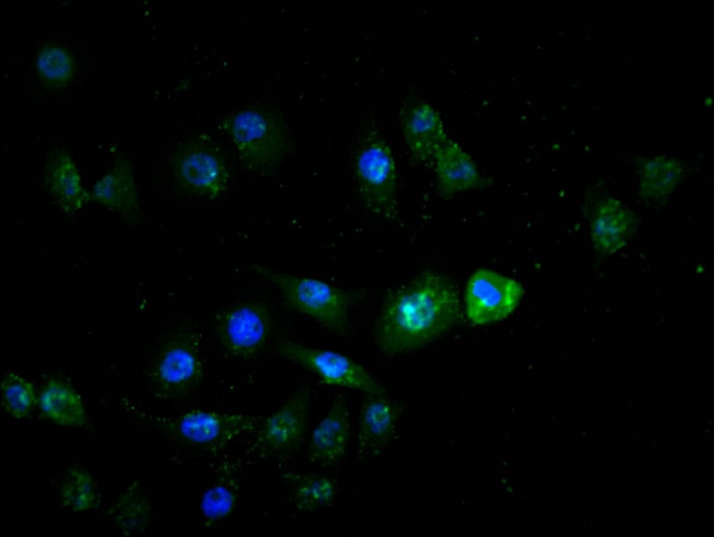 HNF-4 alpha/NR2A1 Antibody (10A7)