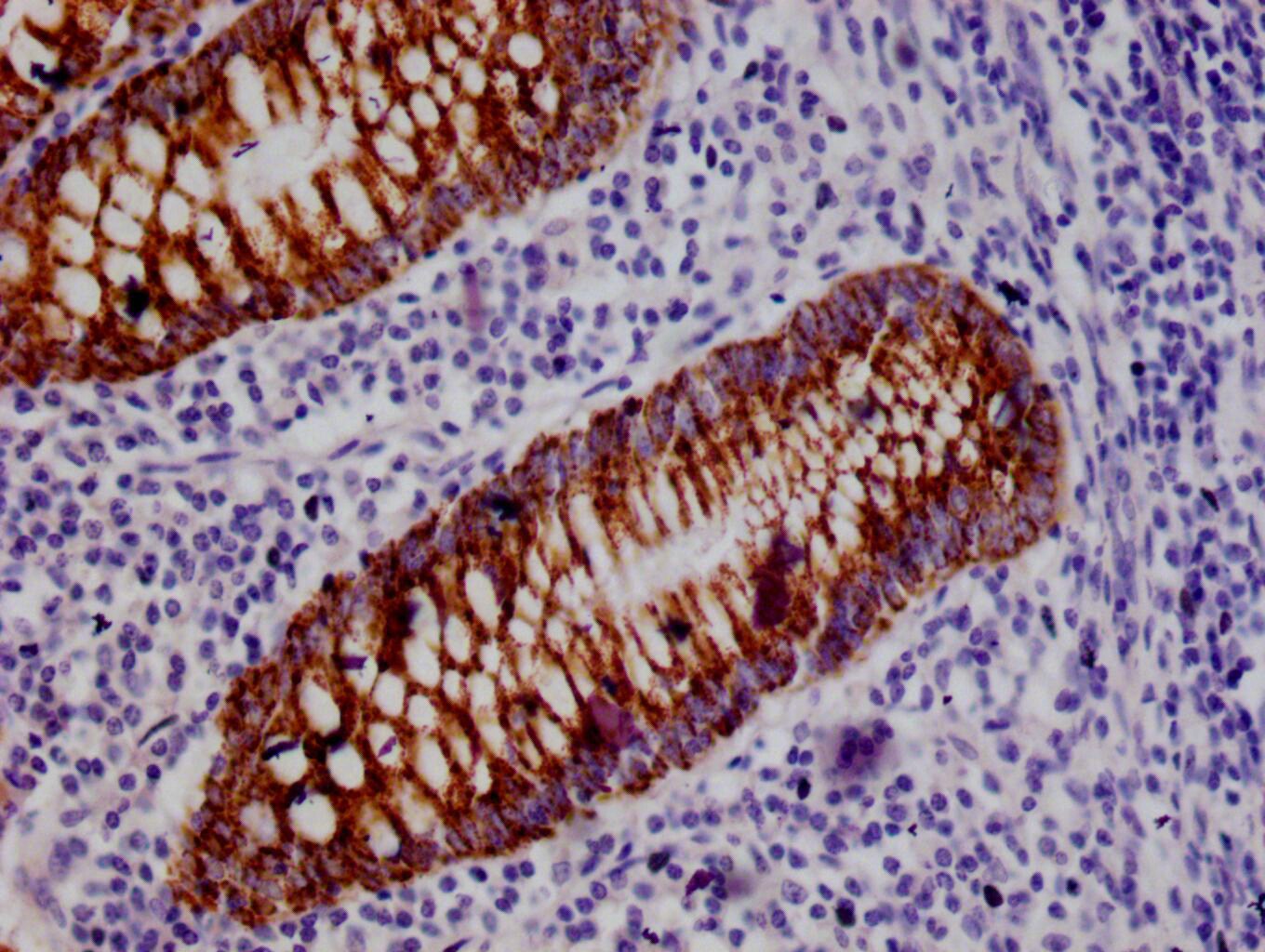 HMGCS2 Antibody (19C11)