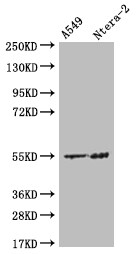 HMGCS2 Antibody (19C11)