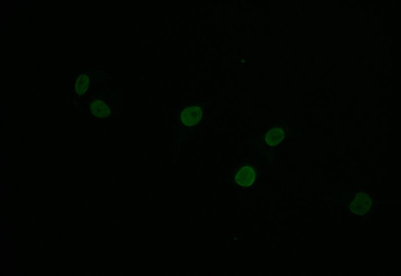Histone H1.2 Antibody (16H4)