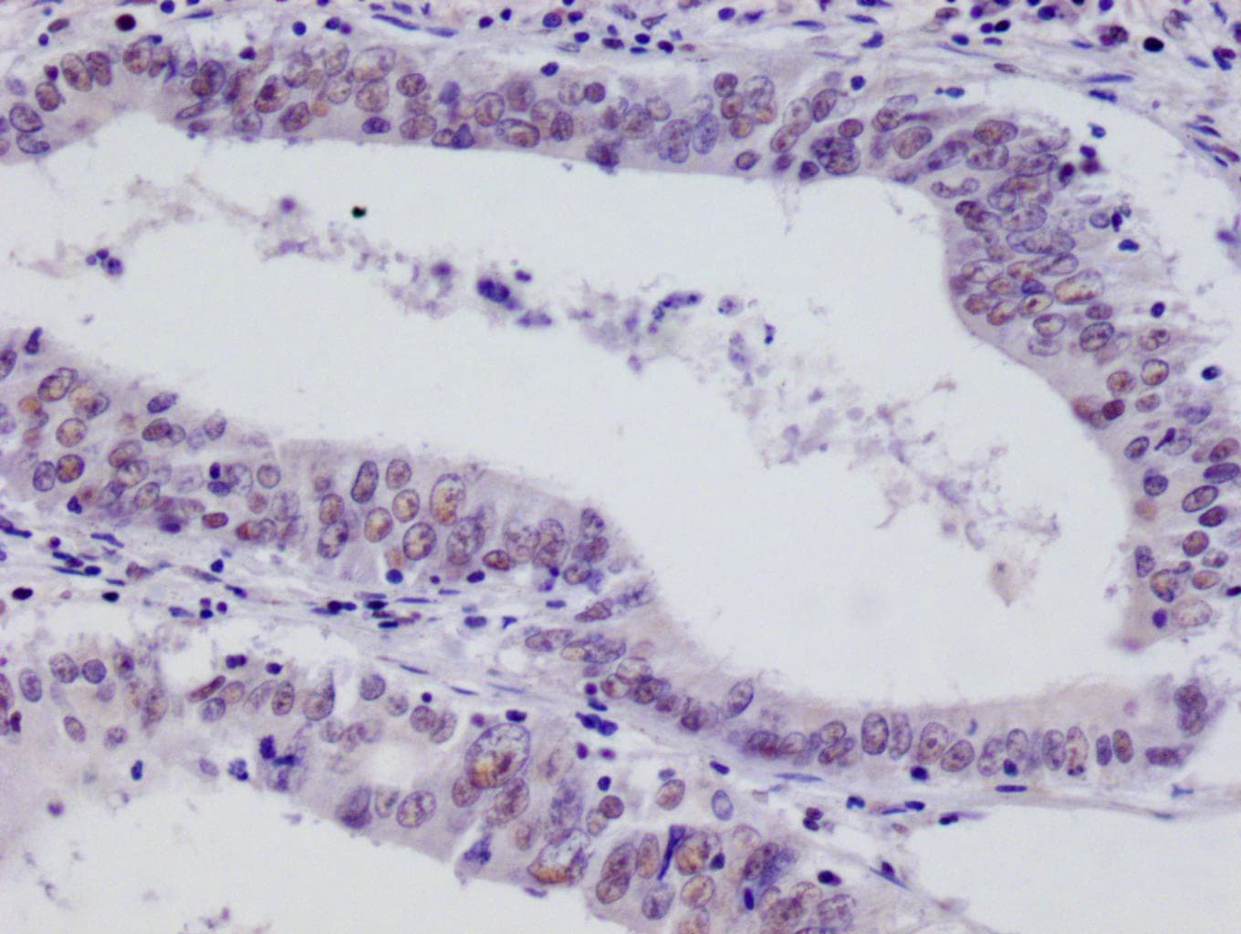 FIH-1/HIF-1AN Antibody (12F11)