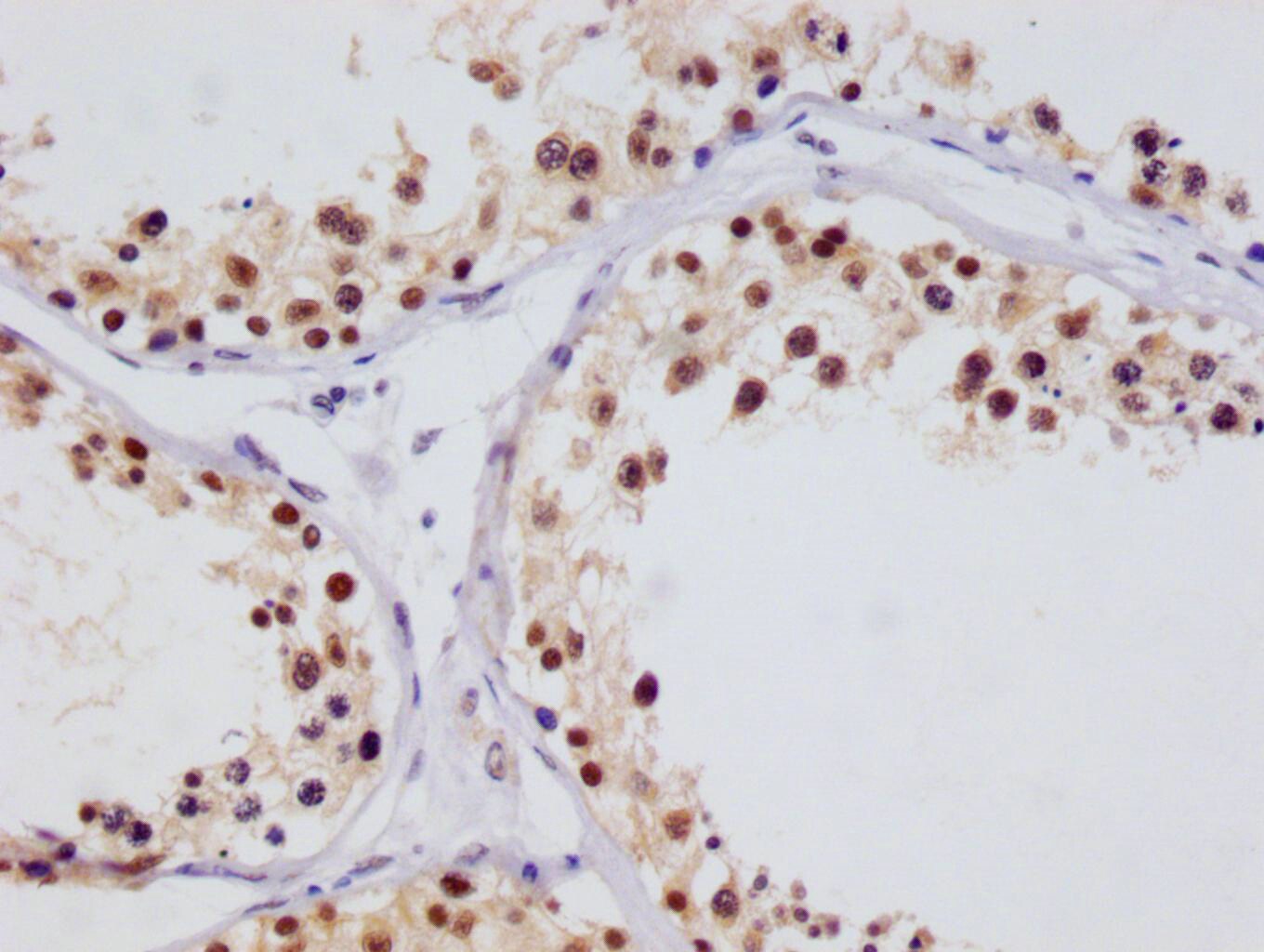 FIH-1/HIF-1AN Antibody (12F11)