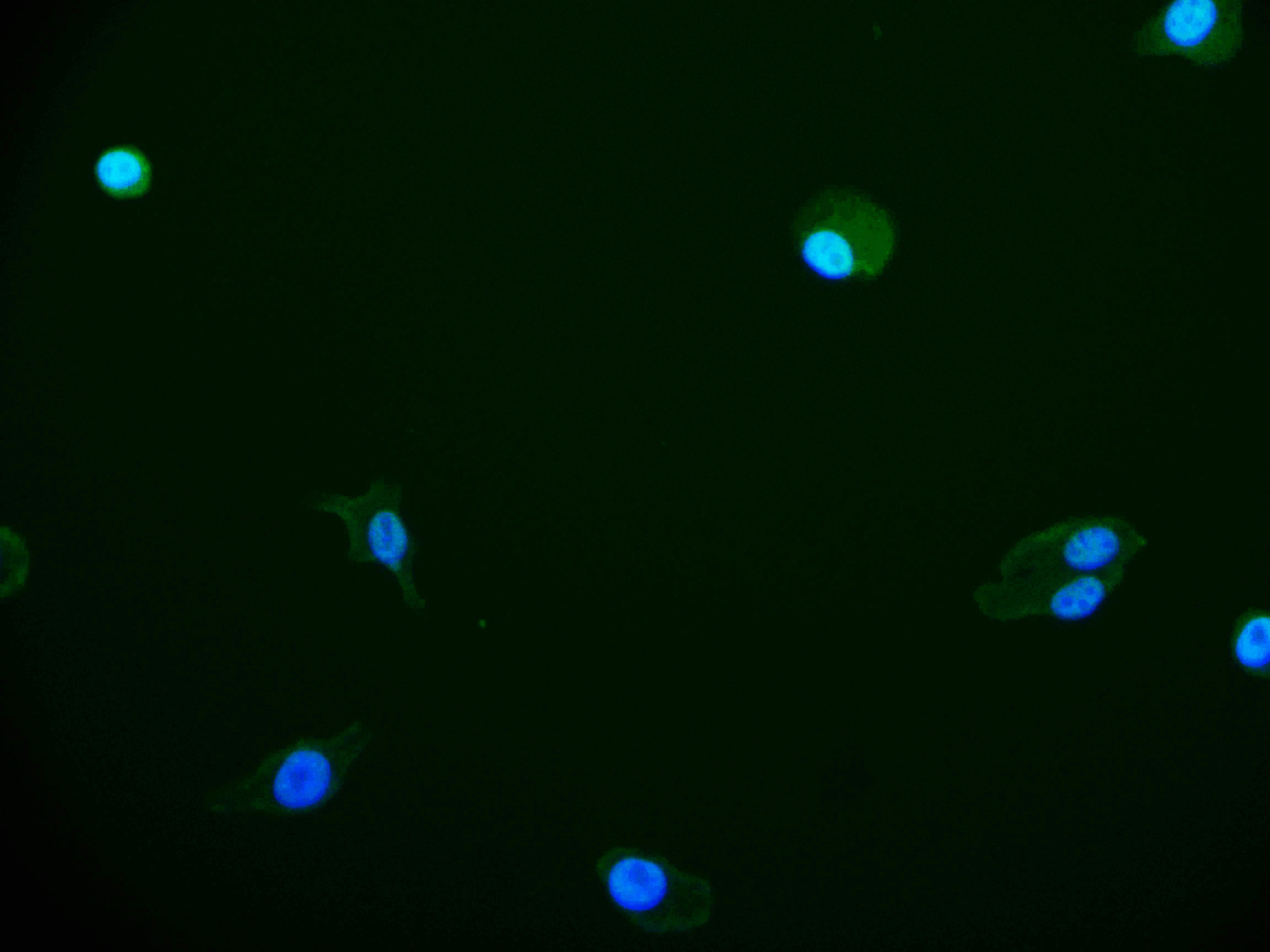 FIH-1/HIF-1AN Antibody (12F11)