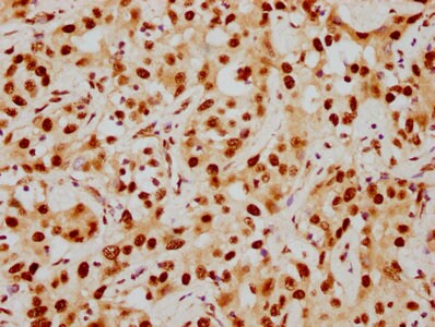 HDAC9 Antibody (1F2)
