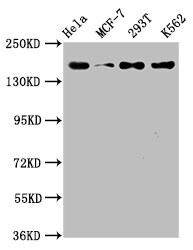 HDAC9 Antibody (1F2)