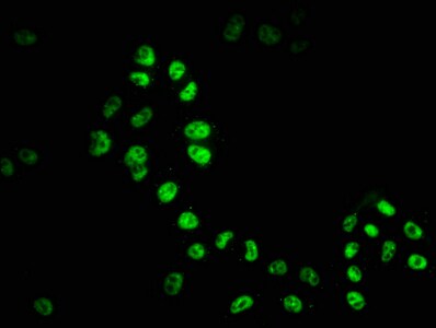 HDAC9 Antibody (1F2)