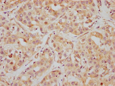 HDAC6 Antibody (2H12)
