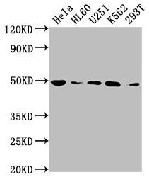 HDAC3 Antibody (4D4)