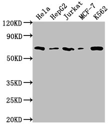 Histone Deacetylase 2/HDAC2 Antibody (9E9)