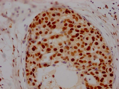 Histone Deacetylase 2/HDAC2 Antibody (9H4)