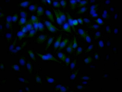 Histone Deacetylase 2/HDAC2 Antibody (9H4)