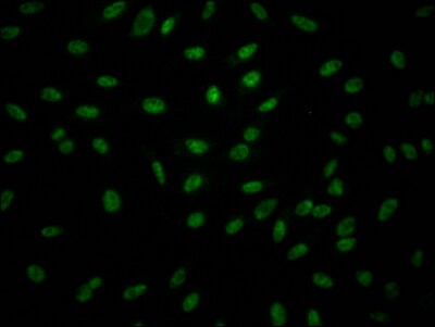Granzyme B Antibody (6A1)