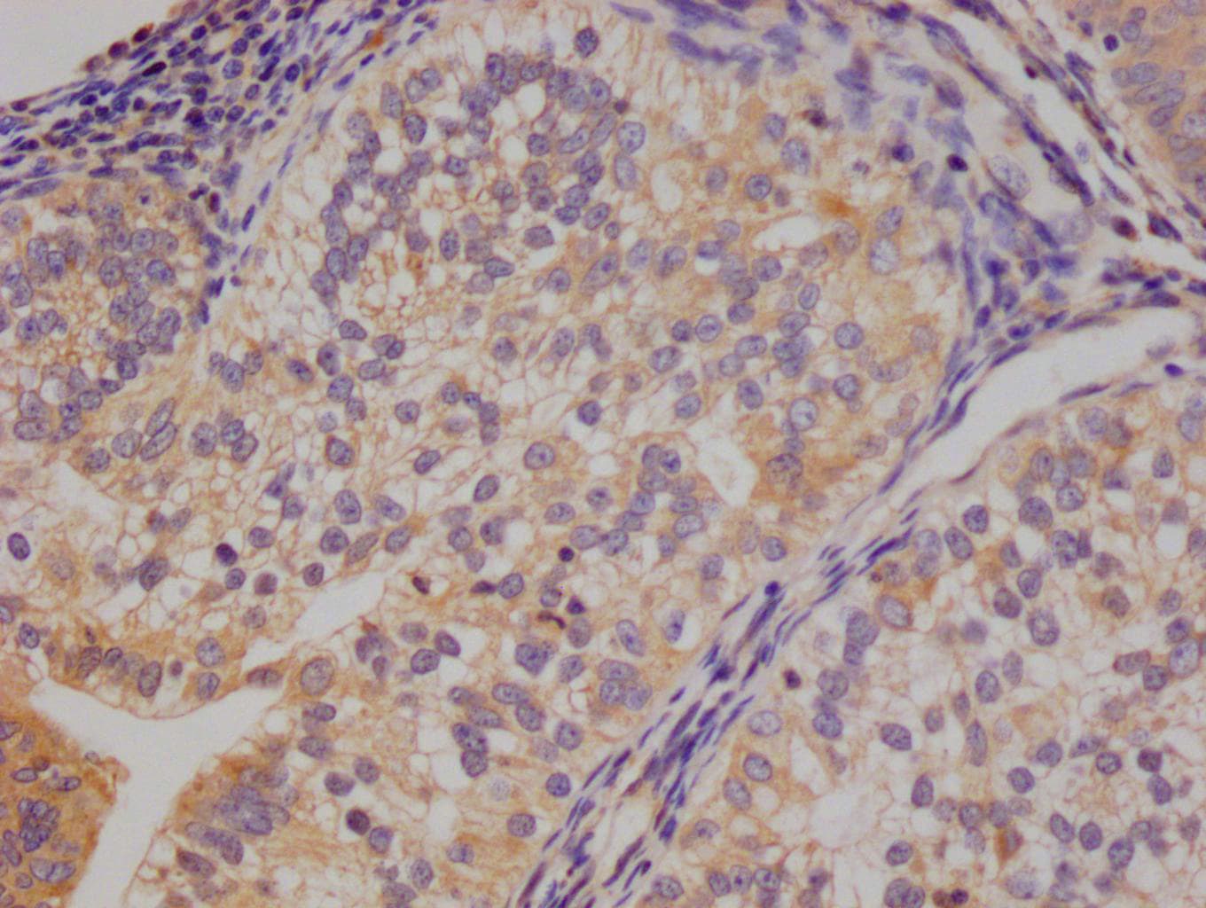 14-3-3 gamma Antibody (13C9)