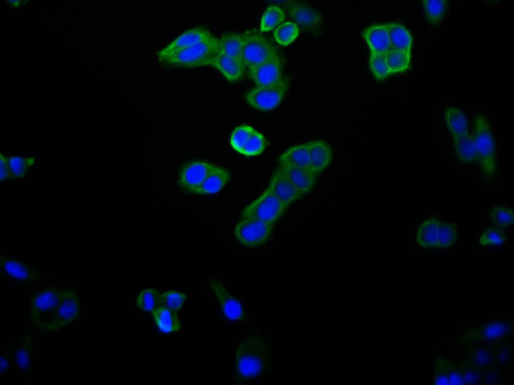 14-3-3 beta/alpha Antibody (6F6)