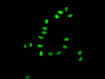 Ku80/XRCC5 Antibody (5G3)